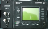 FIBERSCAN1000����ͼ